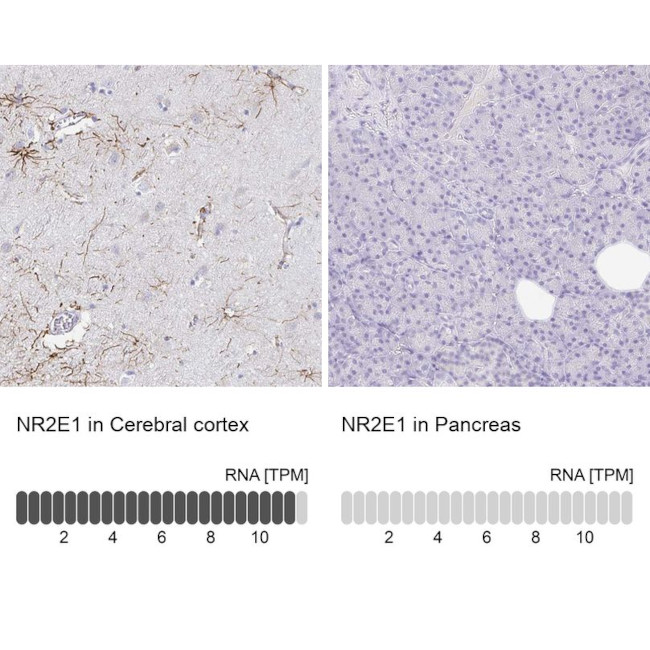 TLX Antibody