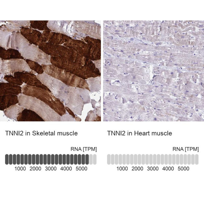 TNNI2 Antibody