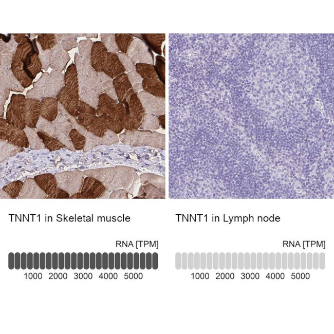 TNNT1 Antibody