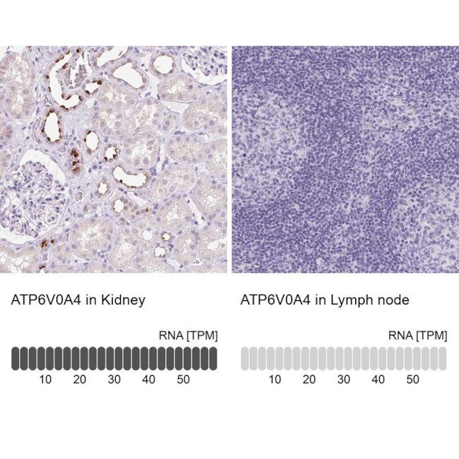 ATP6V0A4 Antibody