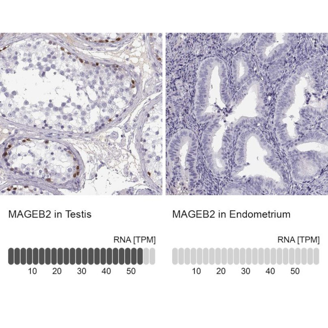 MAGEB2 Antibody