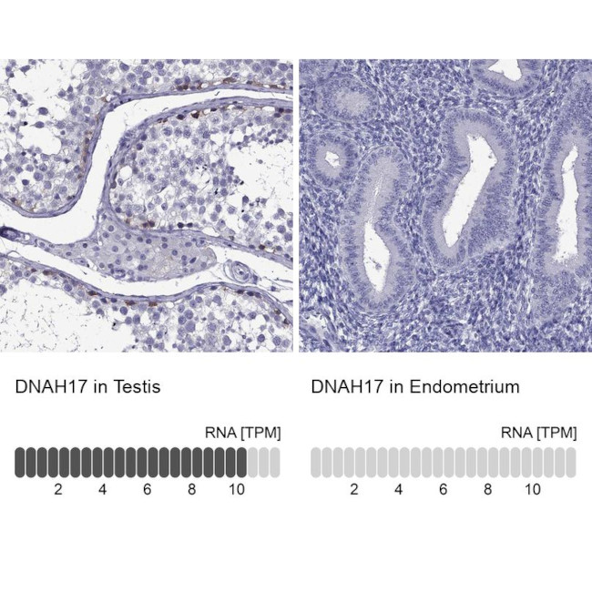 DNAH17 Antibody