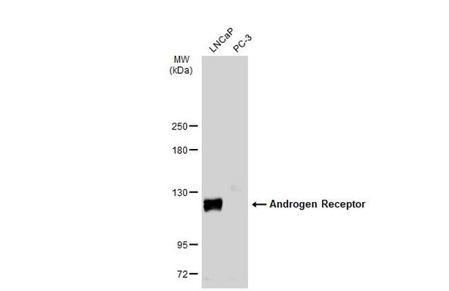 Androgen Receptor Antibody in Western Blot (WB)