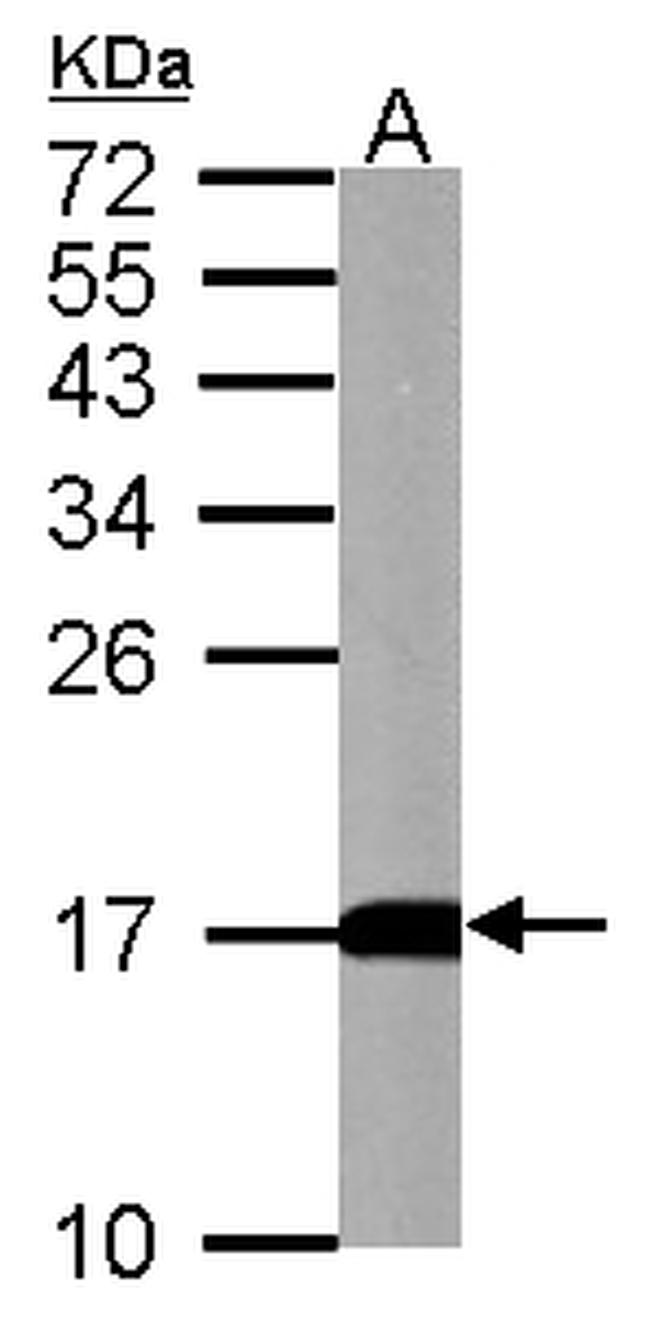 LC3B Antibody in Western Blot (WB)