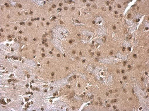 SOD1 Antibody in Immunohistochemistry (Paraffin) (IHC (P))