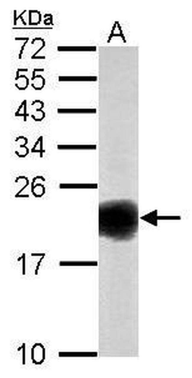 SOD1 Antibody in Western Blot (WB)