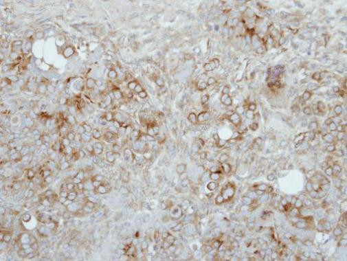 Presenilin 1 Antibody in Immunohistochemistry (Paraffin) (IHC (P))