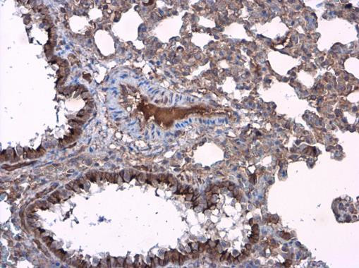 Presenilin 1 Antibody in Immunohistochemistry (Paraffin) (IHC (P))