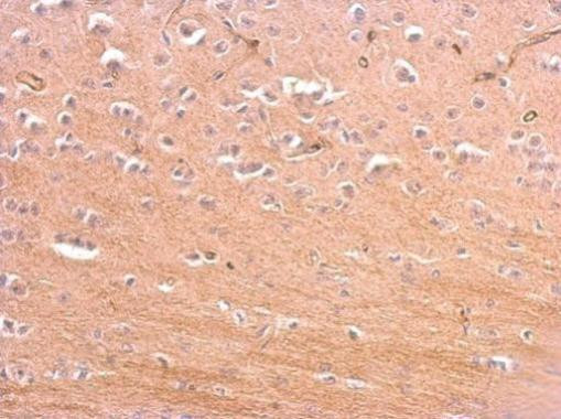 Presenilin 1 Antibody in Immunohistochemistry (Paraffin) (IHC (P))