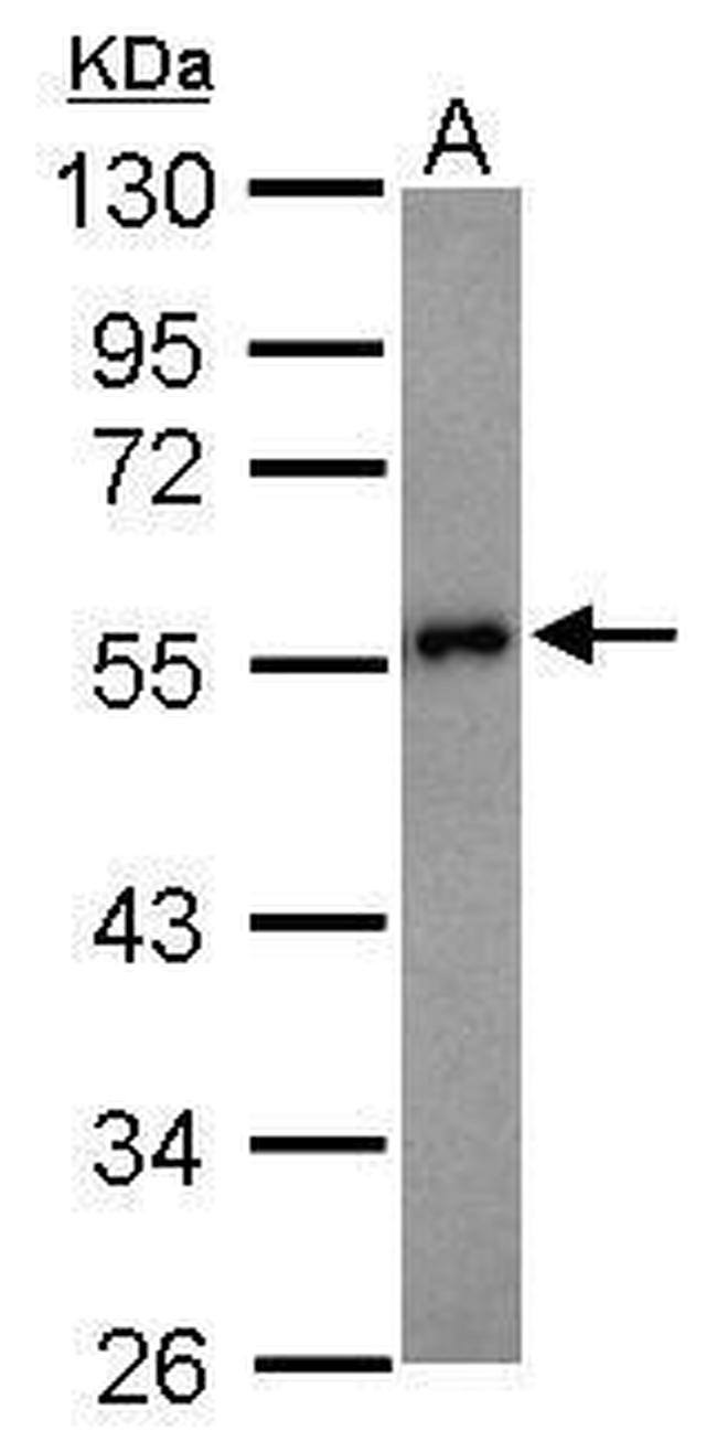 Presenilin 1 Antibody in Western Blot (WB)