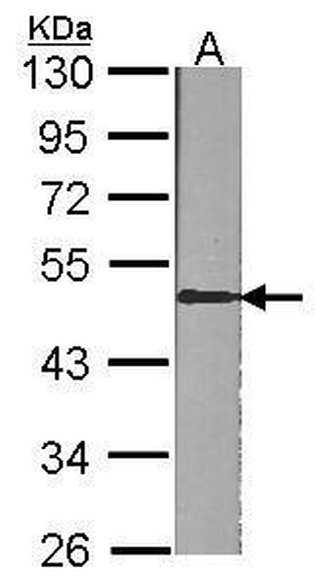 Presenilin 1 Antibody in Western Blot (WB)