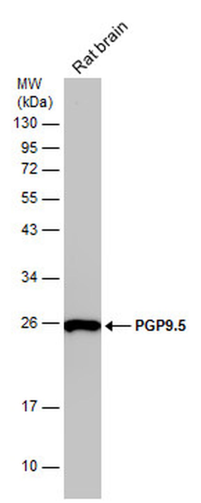 PGP9.5 Antibody in Western Blot (WB)