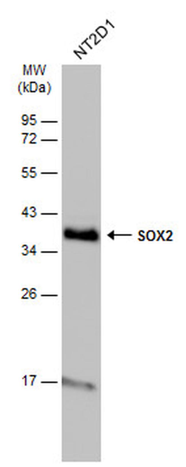 SOX2 Polyclonal Antibody (PA5-85144)