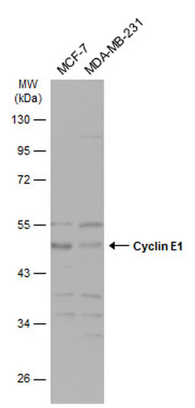 Cyclin E Antibody in Western Blot (WB)