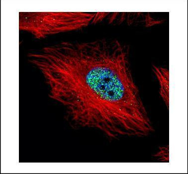 Cyclin E Antibody in Immunocytochemistry (ICC/IF)