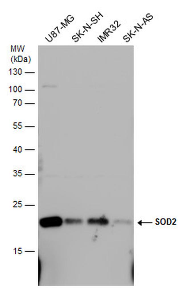 SOD2 Antibody in Western Blot (WB)