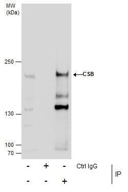 CSB Antibody in Immunoprecipitation (IP)