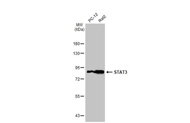 STAT3 Antibody in Western Blot (WB)