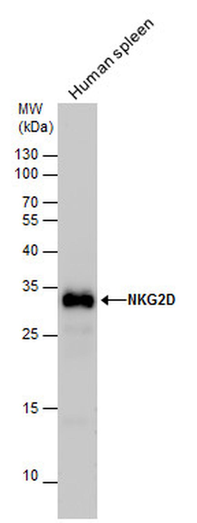 NKG2D Antibody in Western Blot (WB)