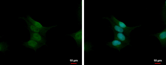 Calcineurin A Antibody in Immunocytochemistry (ICC/IF)