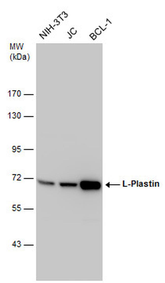 L-Plastin Antibody in Western Blot (WB)