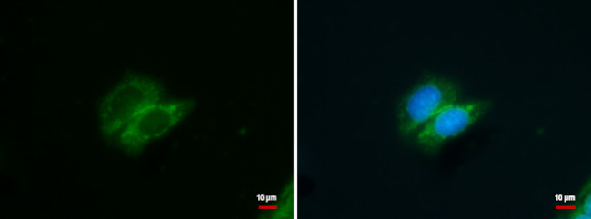 GALK1 Antibody in Immunocytochemistry (ICC/IF)