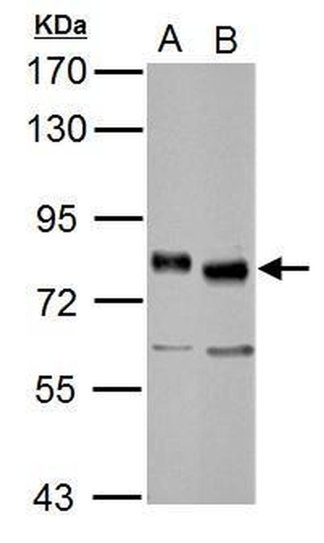 TCF3 Antibody in Western Blot (WB)