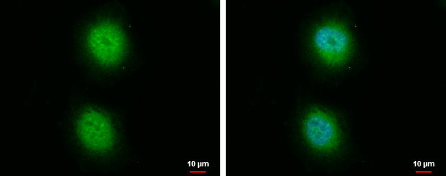 PP5 Antibody in Immunocytochemistry (ICC/IF)