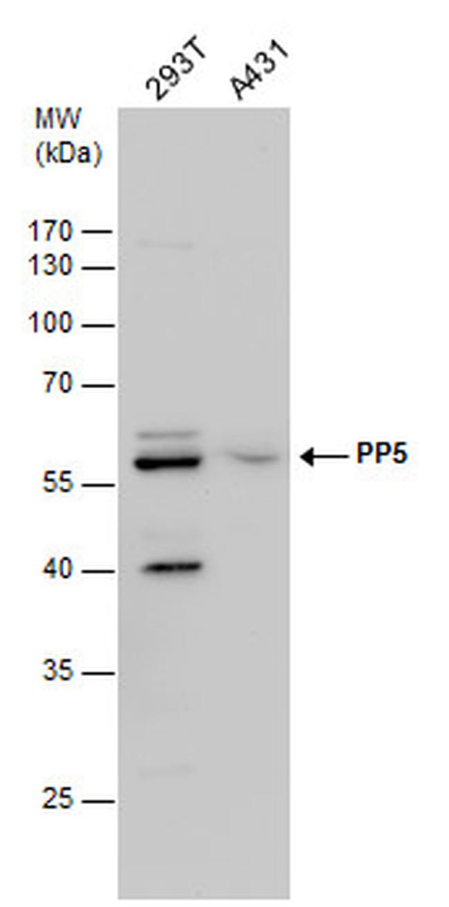 PP5 Antibody in Western Blot (WB)