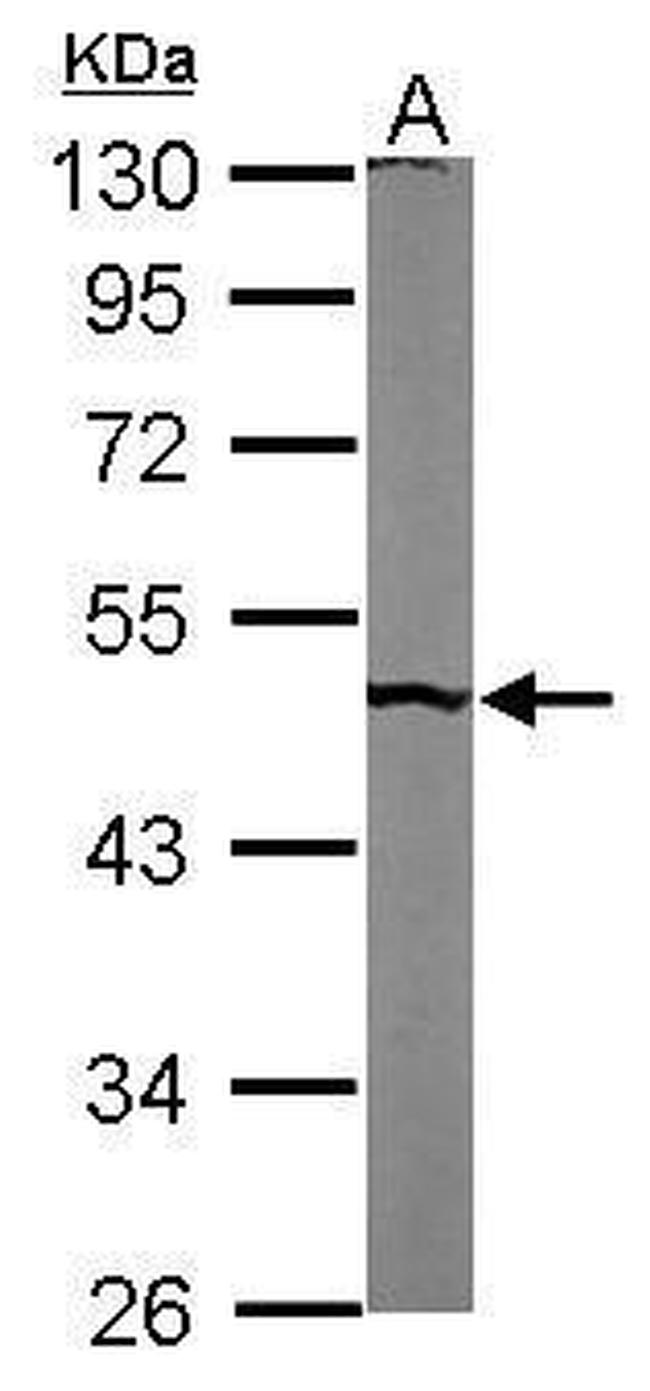 PUS1 Antibody in Western Blot (WB)