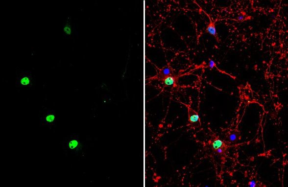 Phospho-MEF2C (Thr20) Antibody in Immunocytochemistry (ICC/IF)