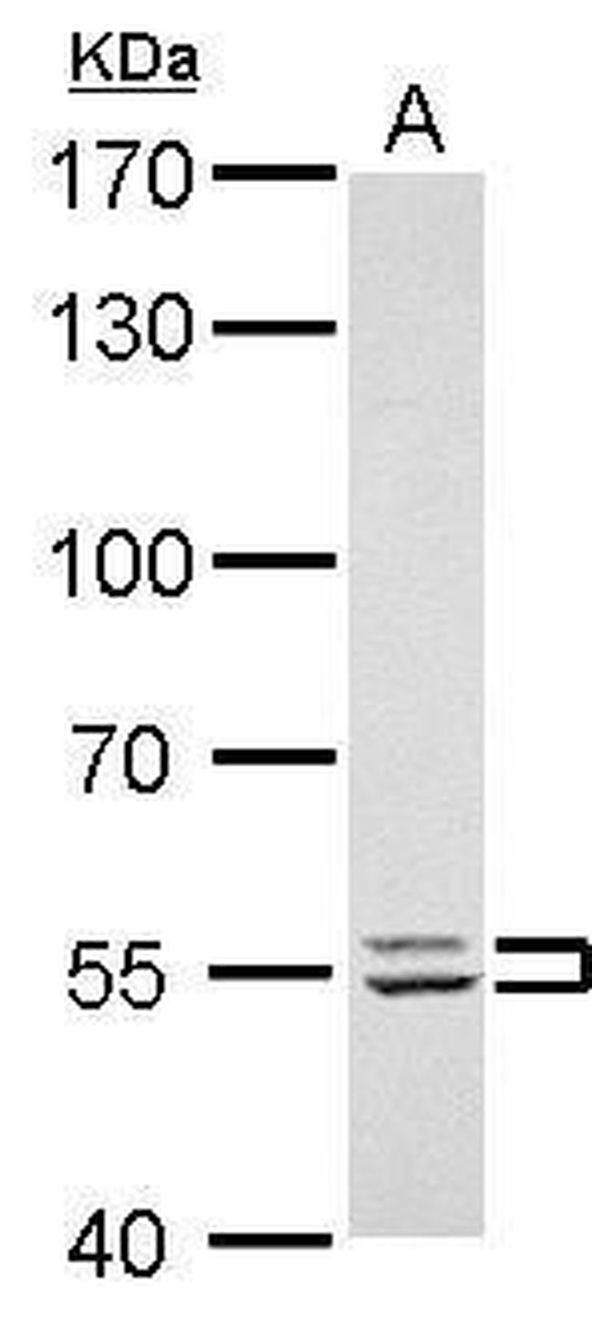 Lyn Antibody in Western Blot (WB)