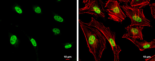 NPM1 Antibody in Immunocytochemistry (ICC/IF)