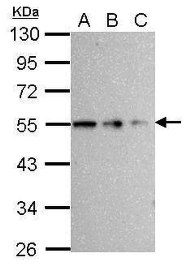 beta Tubulin Antibody in Western Blot (WB)