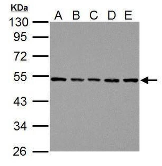 beta Tubulin Antibody in Western Blot (WB)