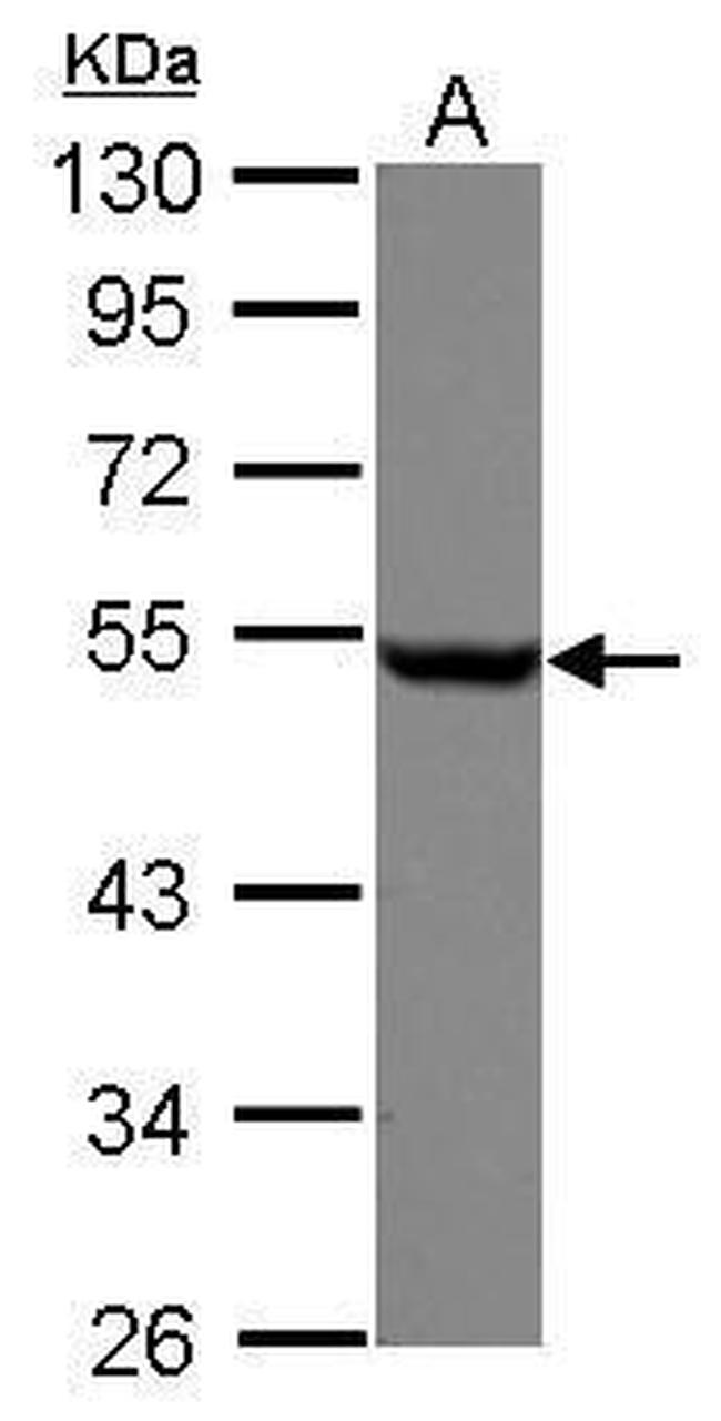 beta Tubulin Antibody in Western Blot (WB)