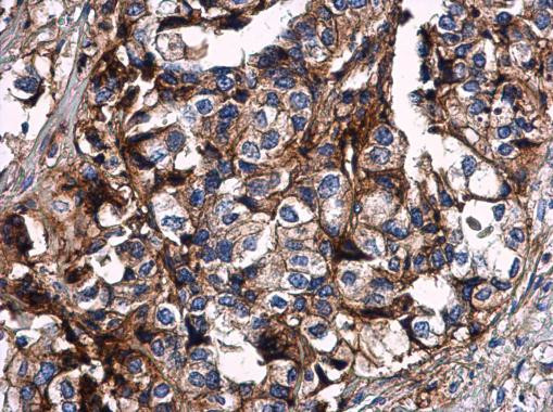 HLA-G Antibody in Immunohistochemistry (Paraffin) (IHC (P))