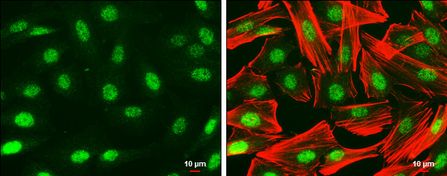 PAX6 Antibody in Immunocytochemistry (ICC/IF)