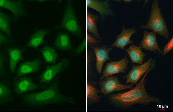 PAX6 Antibody in Immunocytochemistry (ICC/IF)