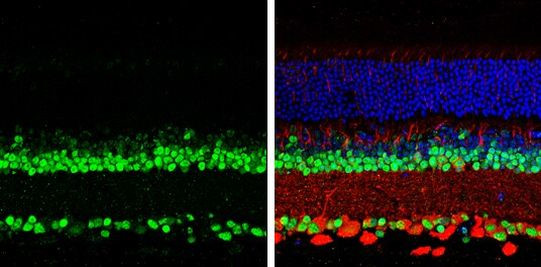 PAX6 Antibody in Immunohistochemistry (Paraffin) (IHC (P))