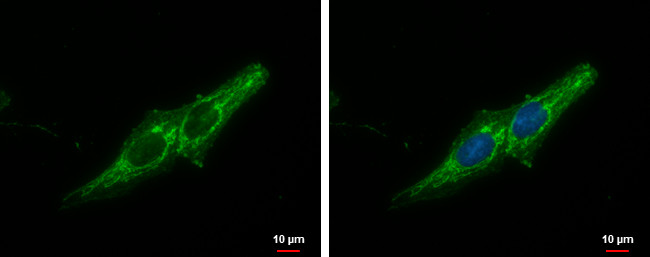 Prohibitin Antibody in Immunocytochemistry (ICC/IF)