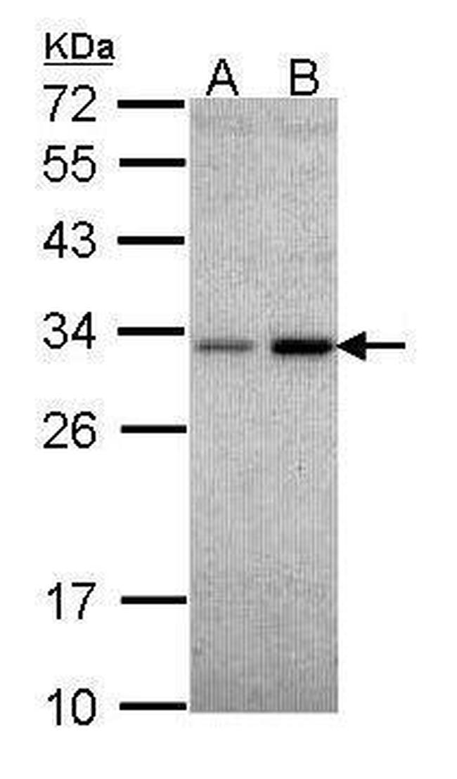 NQO1 Antibody in Western Blot (WB)