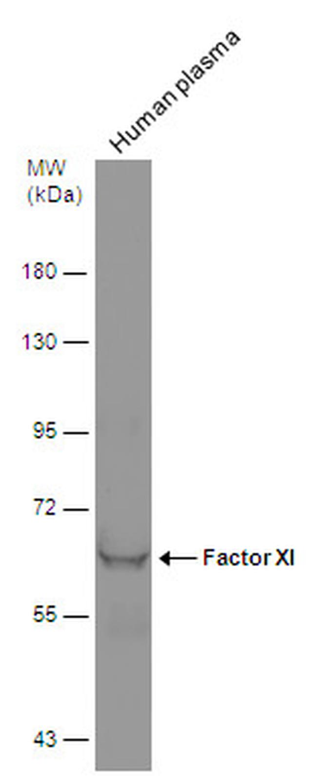 Factor XI Antibody in Western Blot (WB)