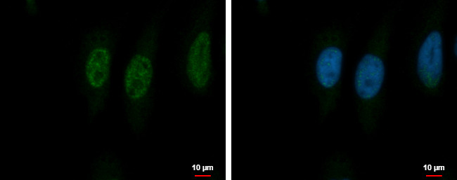 PSMA5 Antibody in Immunocytochemistry (ICC/IF)