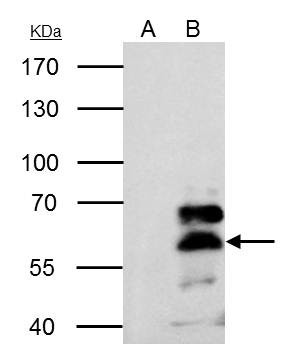 RXRA Antibody in Immunoprecipitation (IP)