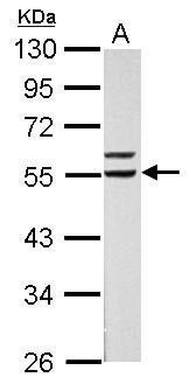 RXRA Antibody in Western Blot (WB)