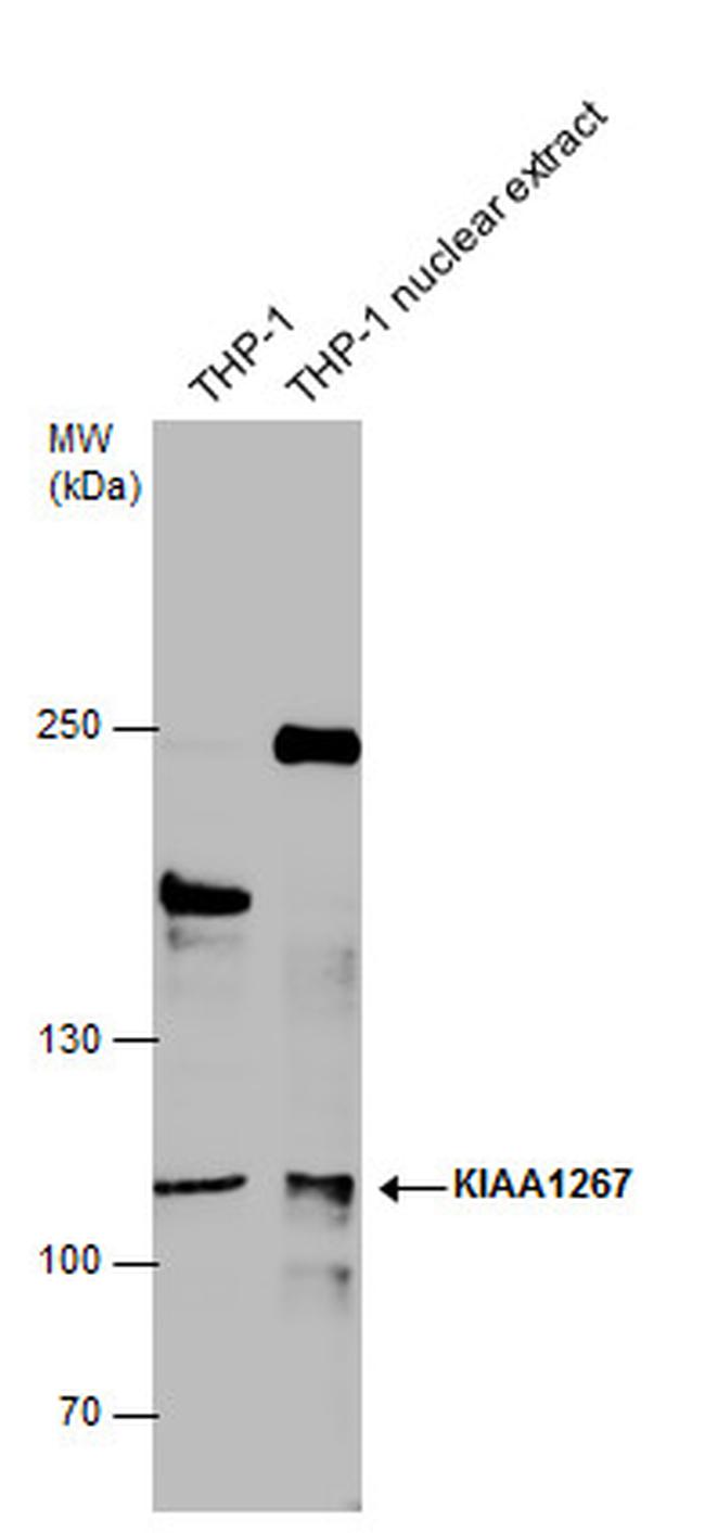 KANSL1 Antibody in Western Blot (WB)