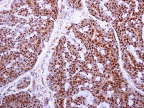 MAFF Antibody in Immunohistochemistry (Paraffin) (IHC (P))