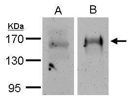 EGFR Antibody in Immunoprecipitation (IP)