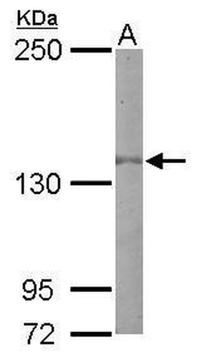 EGFR Antibody in Western Blot (WB)